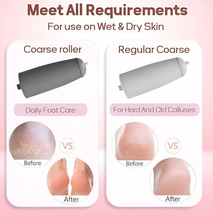 Electronic Cordless Callus Remover